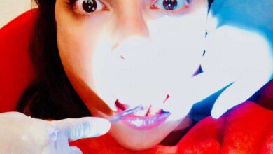 Photo of Stars Share TMI Moments at the Dentist: From Awkward Checkups to Funny Anecdotes